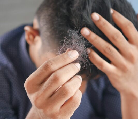 두피 케어에서 탈모 예방까지… 건강한 헤어를 위한 실생활 루틴 a man is combing his hair with his hands